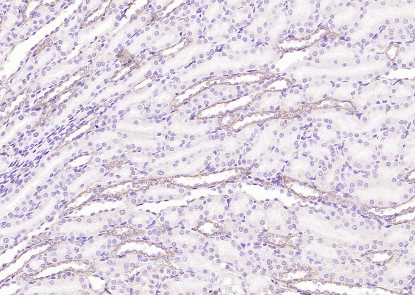 Anti-AGTR1 Polyclonal Antibody