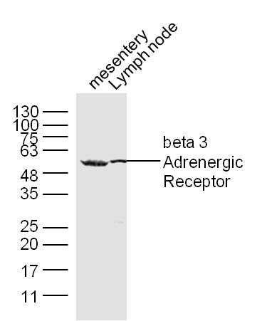 Anti-ADRB3 Polyclonal Antibody 2