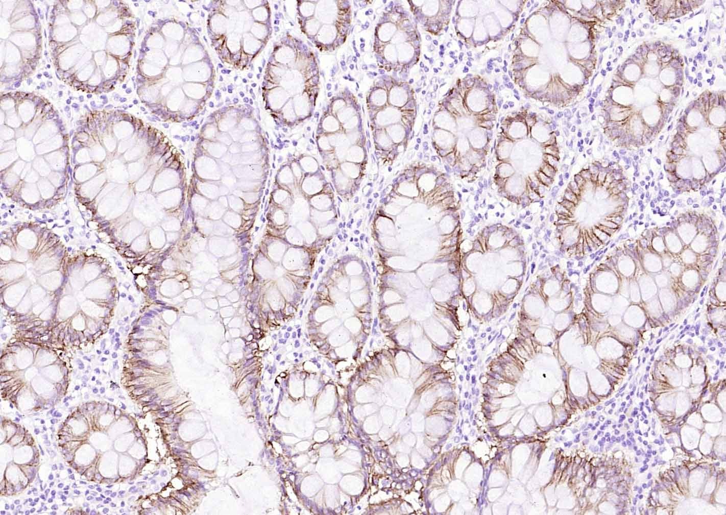 Anti-ATP1A1 Polyclonal Antibody 2