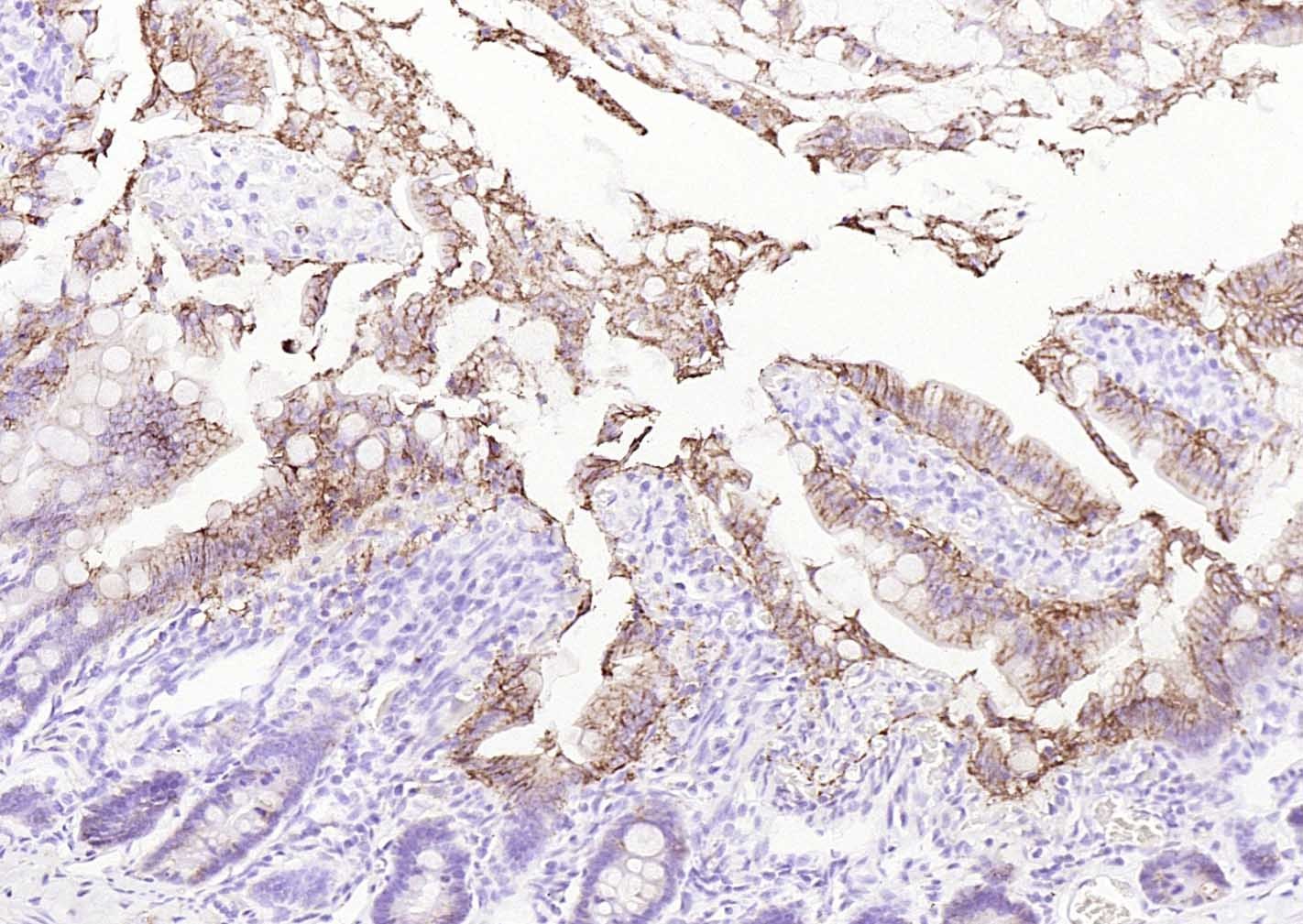 Anti-ATP1A1 Polyclonal Antibody 2