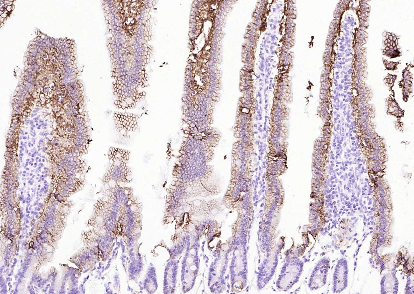 Anti-ATP1A1 Polyclonal Antibody 2