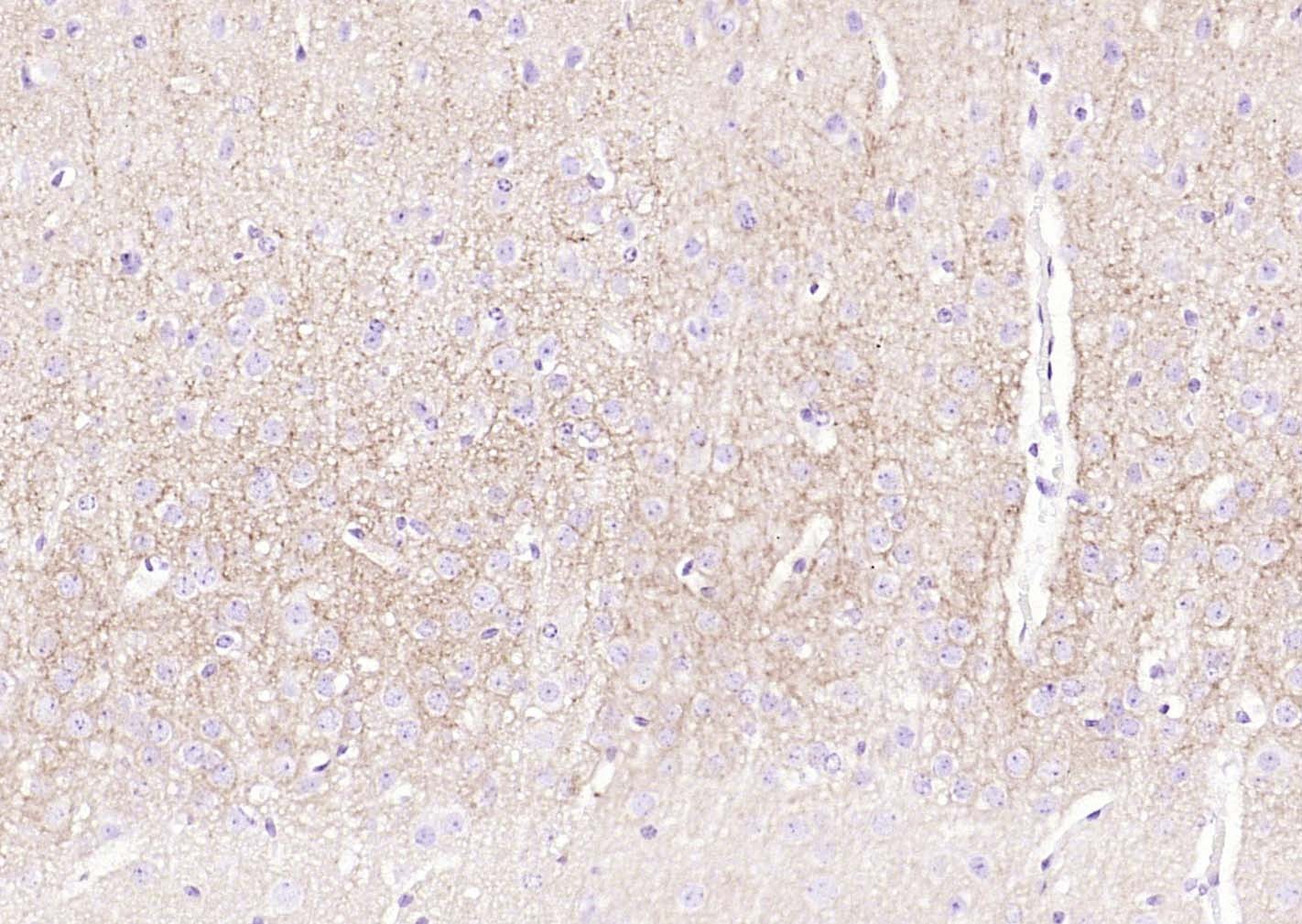 Anti-ATP1A1 Polyclonal Antibody 2