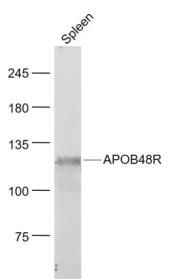 Anti-APOB48R Polyclonal Antibody