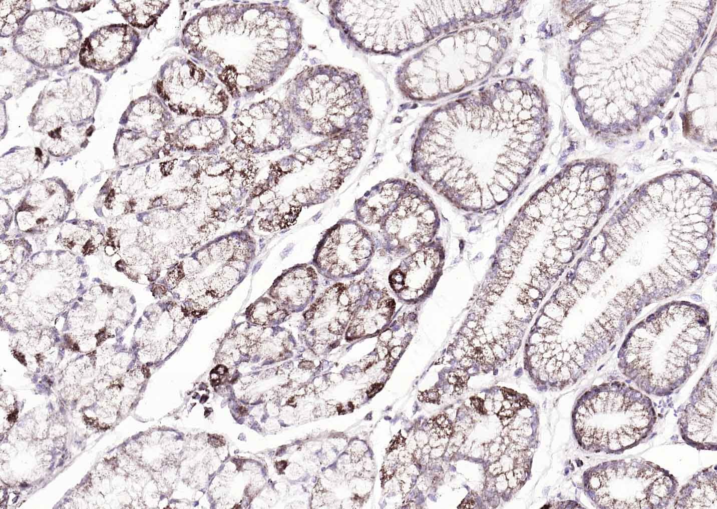 Anti-ATP7B Polyclonal Antibody