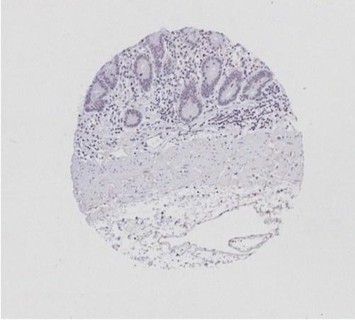 Anti-APCDD1 Polyclonal Antibody