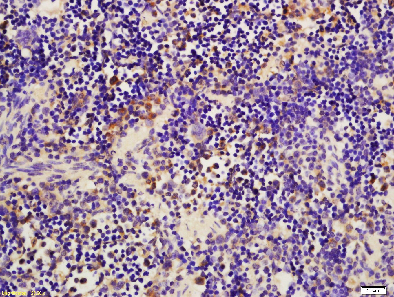 Anti-B2M/beta 2-Microglobulin Polyclonal Antibody