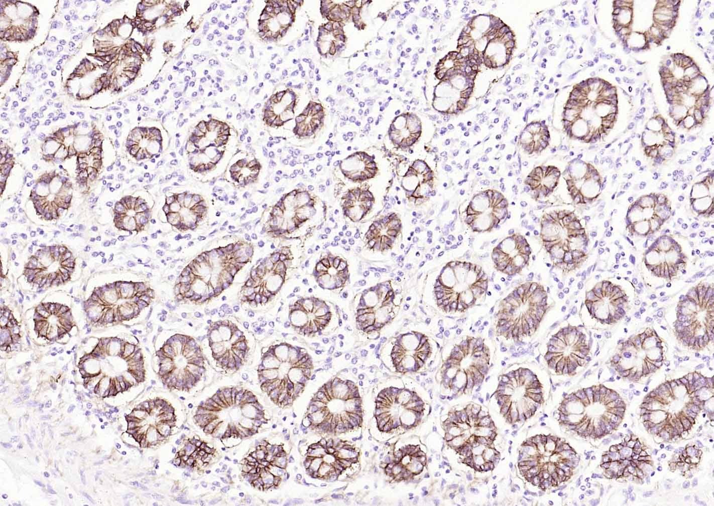 Anti-ATP1A1 Polyclonal Antibody 2
