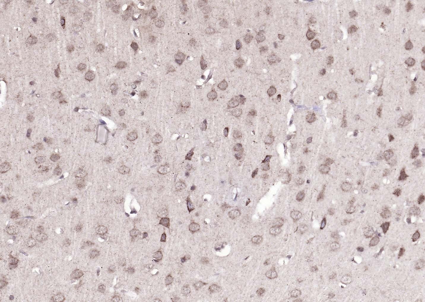 Anti-ATP7B Polyclonal Antibody