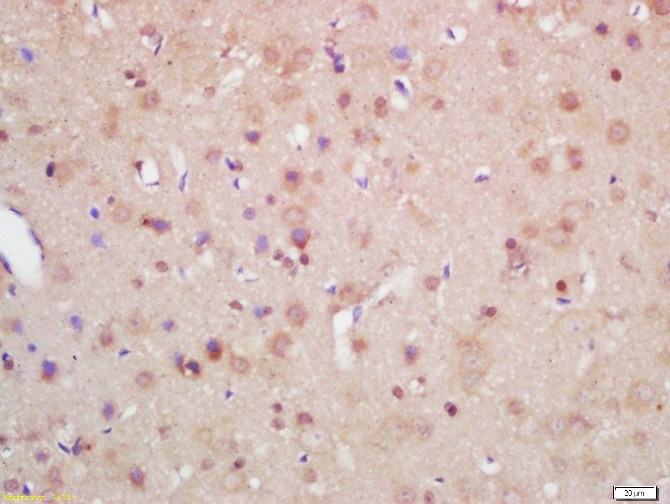 Anti-Axin-2 Polyclonal Antibody