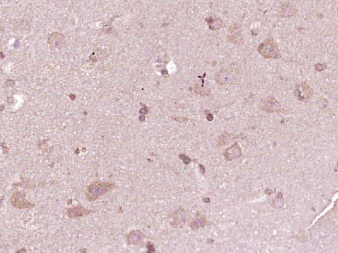 Anti-ATP7A Polyclonal Antibody