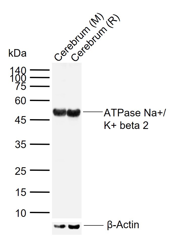 Anti-ATP1B2 Polyclonal Antibody