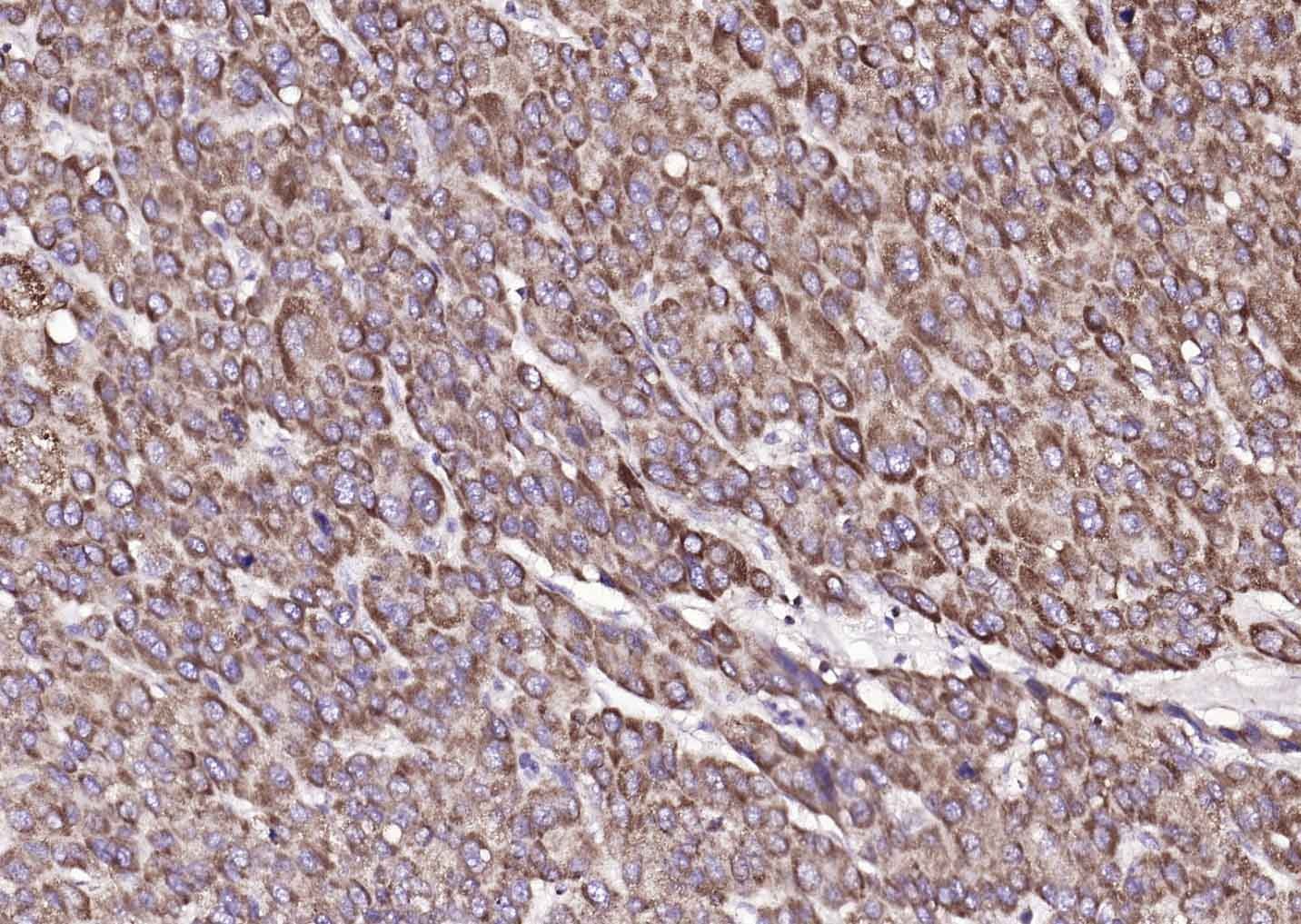 Anti-ATP7B Polyclonal Antibody