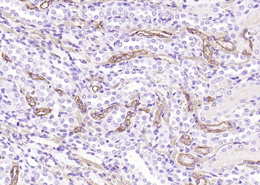 Anti-Aquaporin-1/AQP1 Polyclonal Antibody