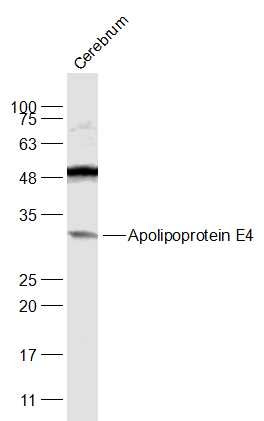 Anti-Apolipoprotein E/APOE4 Polyclonal Antibody