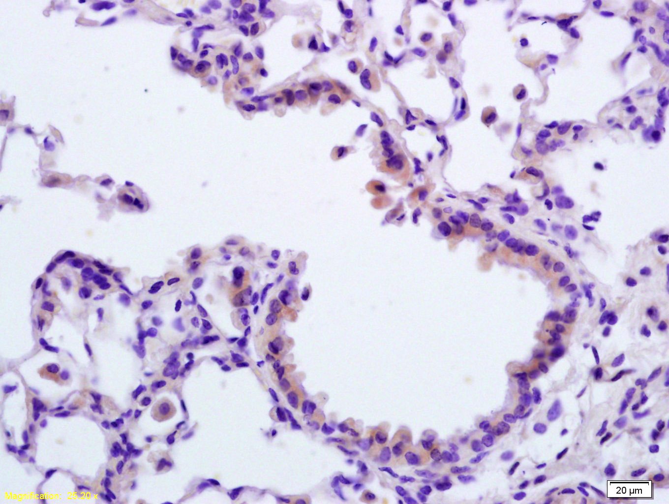 Anti-APAF1(NT) Polyclonal Antibody
