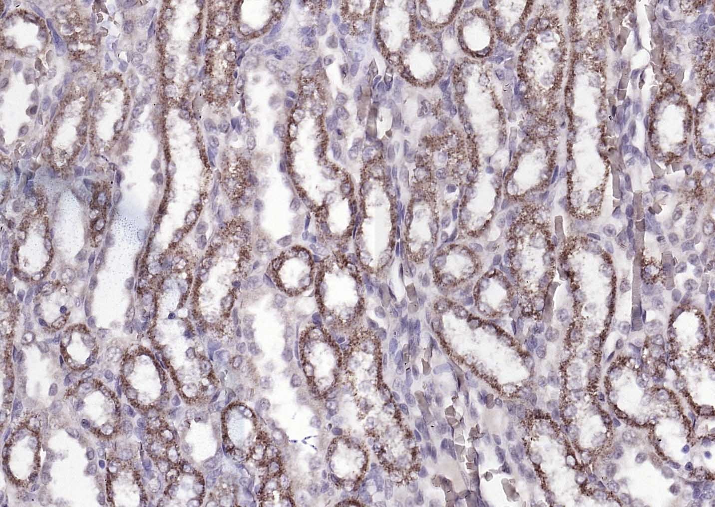 Anti-ATP7B Polyclonal Antibody
