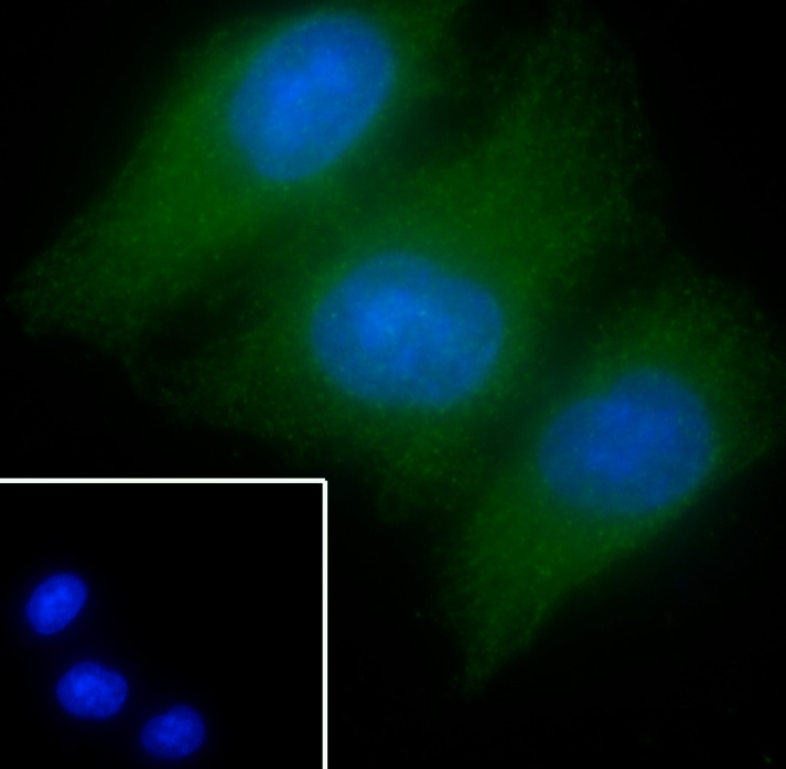 Anti-Aurora B Antibody (9I737)