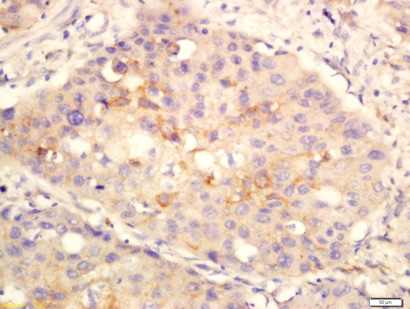 Anti-Anoctamin-1/ANO1 Polyclonal Antibody