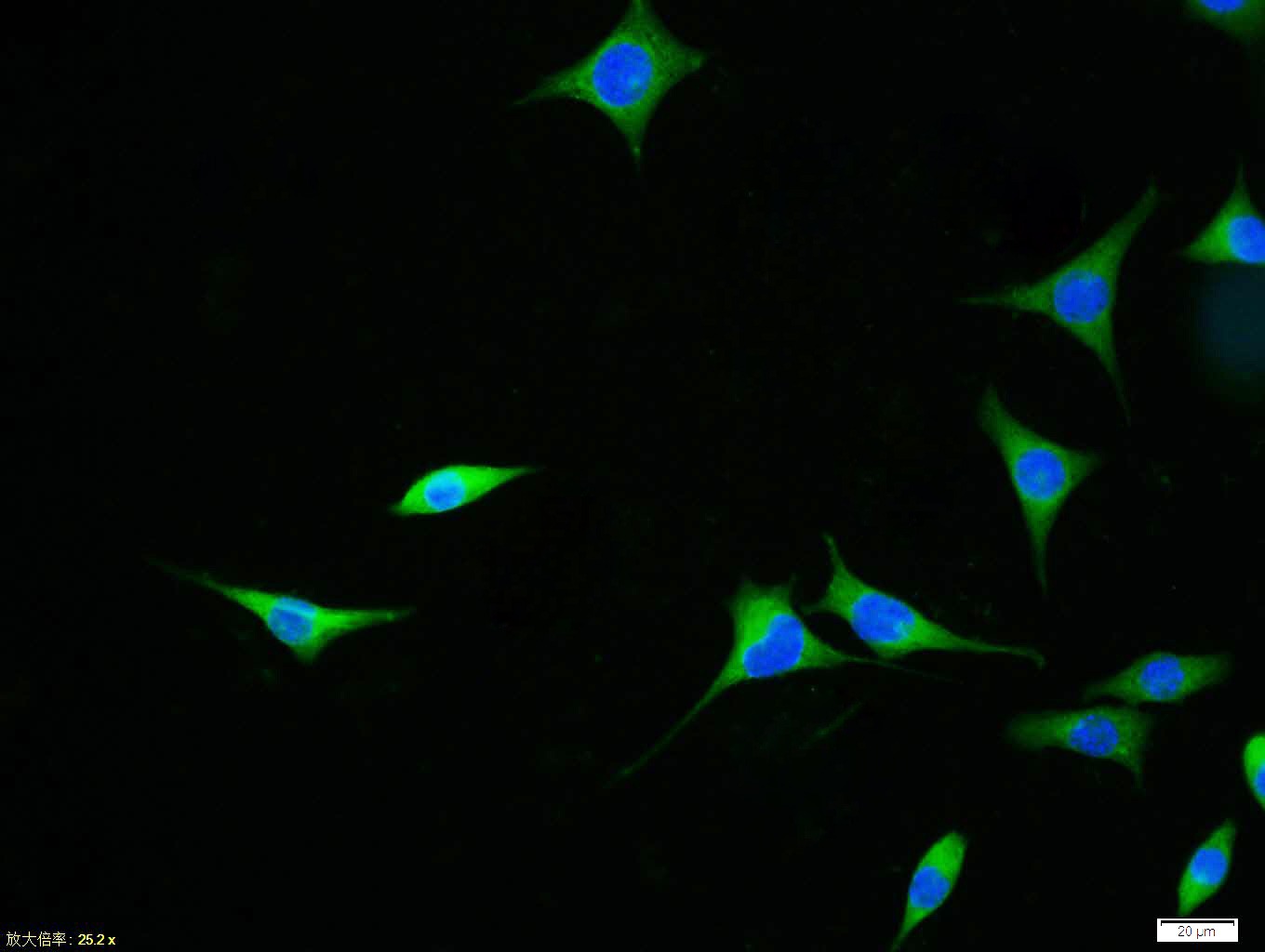 Anti-APAF1(NT) Polyclonal Antibody