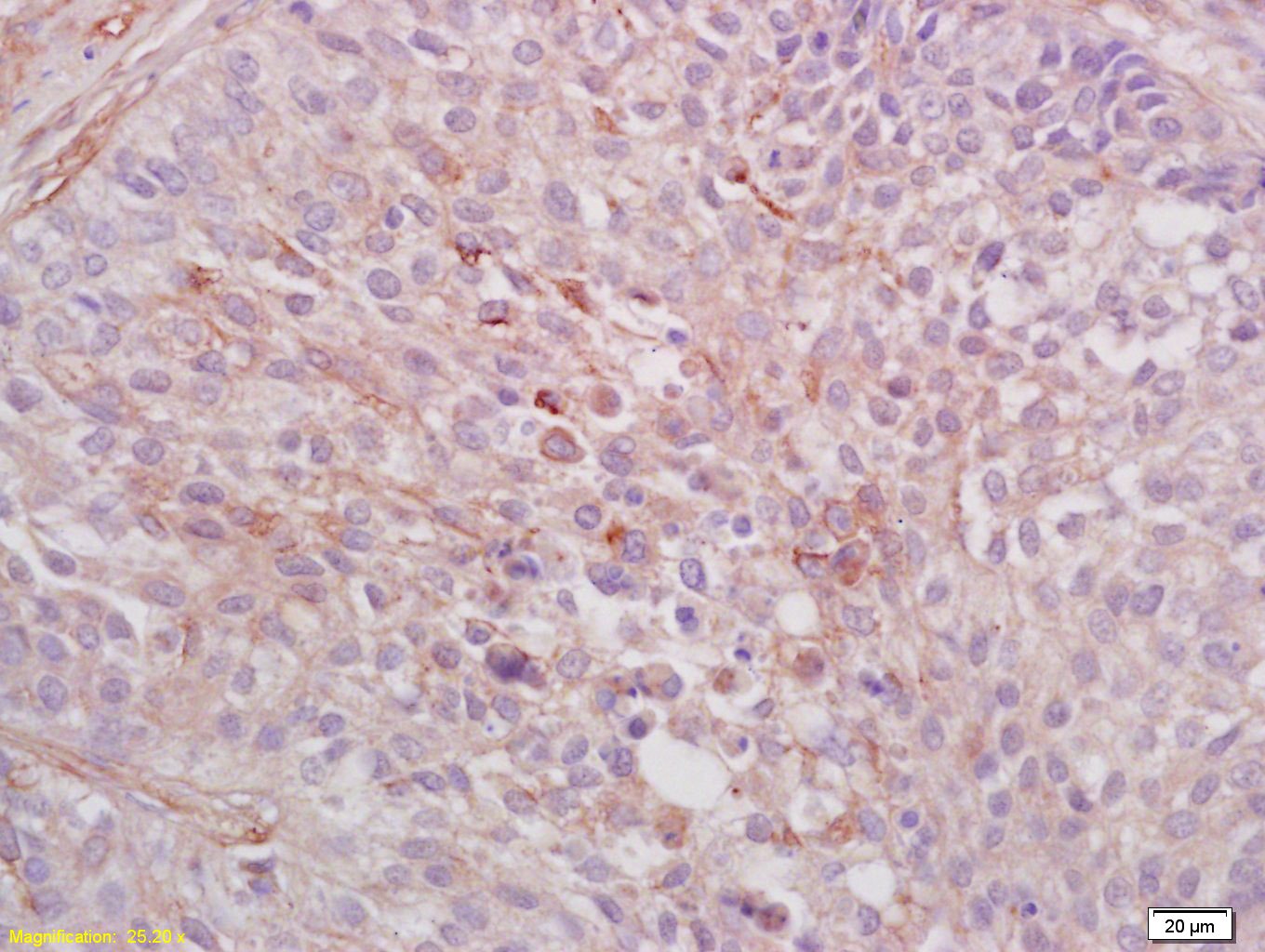 Anti-AXL Polyclonal Antibody