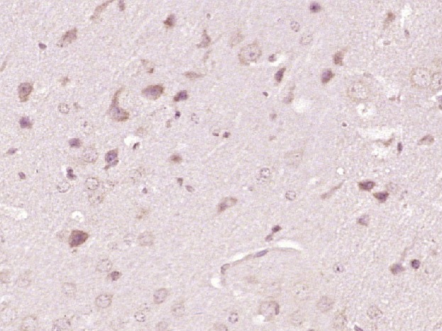 Anti-ATP7A Polyclonal Antibody