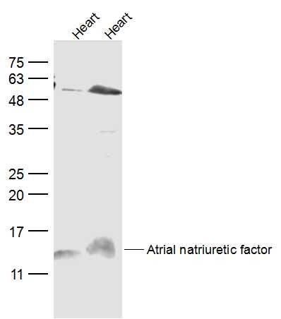 Anti-Atrial natriuretic factor Polyclonal Antibody