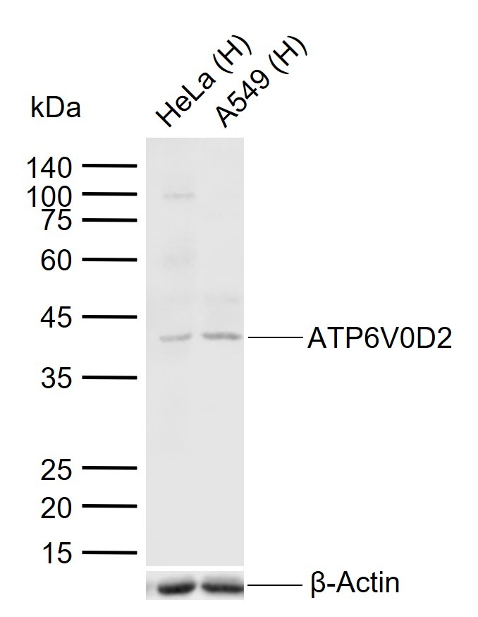 Anti-ATP6V0D2 Polyclonal Antibody
