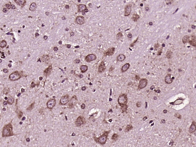 Anti-Axin-2 Polyclonal Antibody