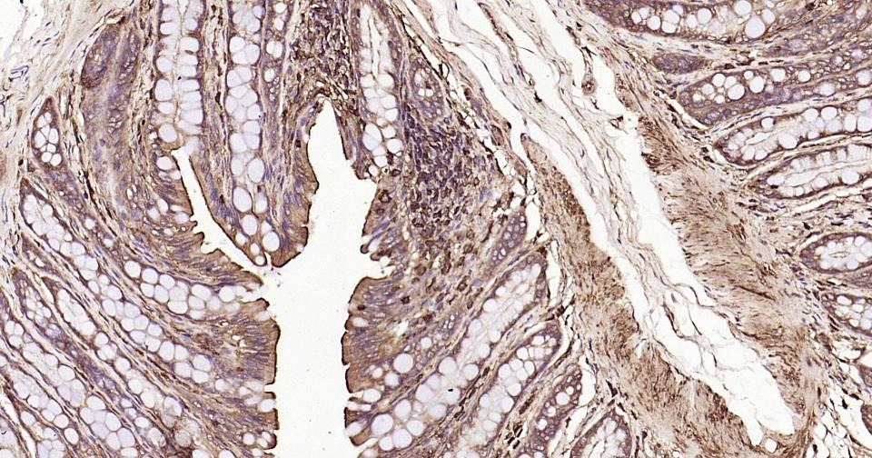 Beta-Actin Loading Control Polyclonal Antibody