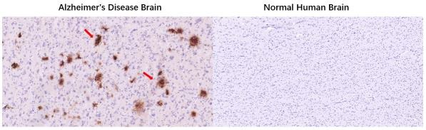 Anti-Beta-Amyloid 1-42 Antibody (6J263)
