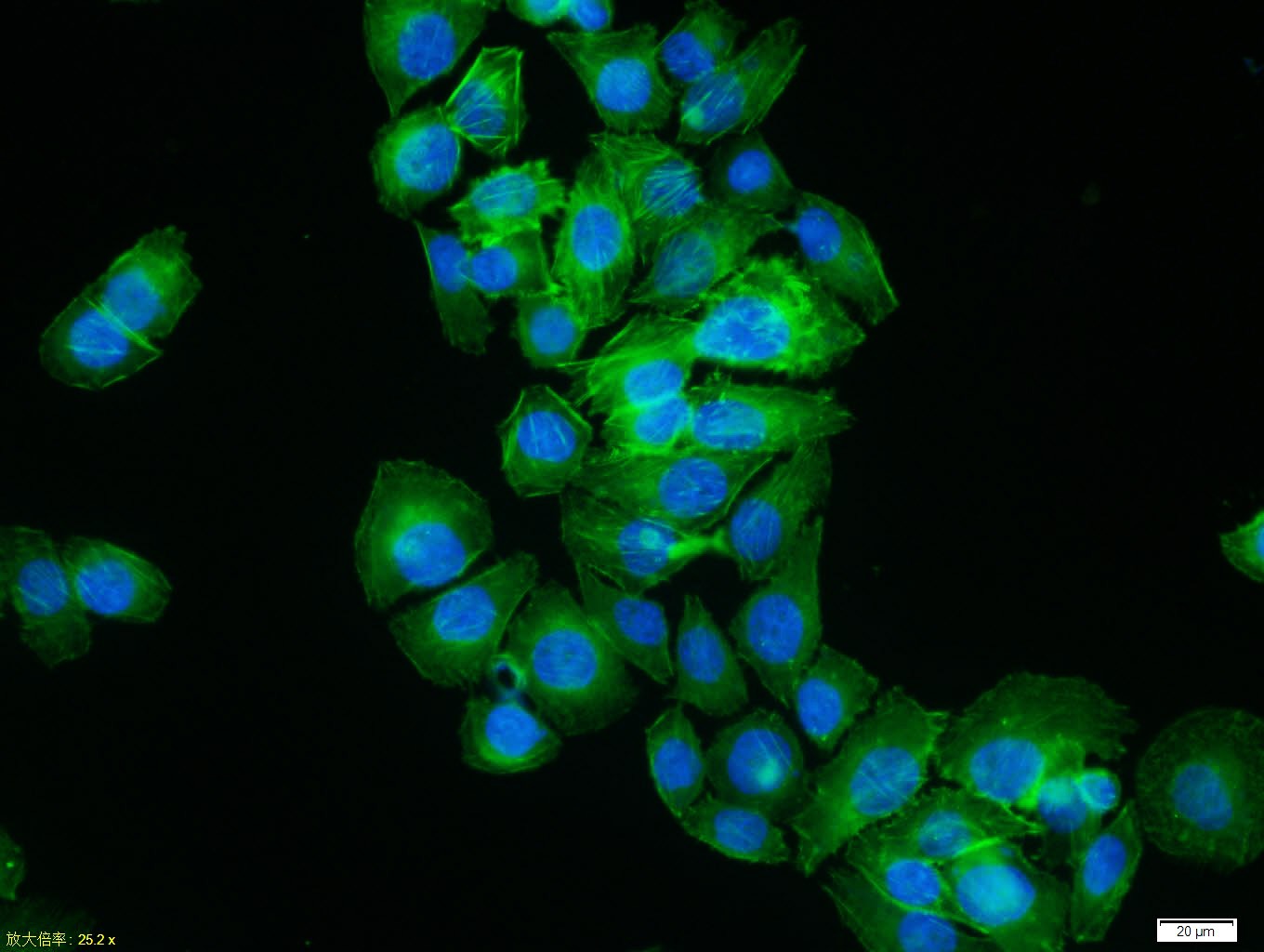Beta-Actin Loading Control Polyclonal Antibody