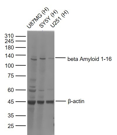 Anti-Beta-Amyloid 1-16 Polyclonal Antibody