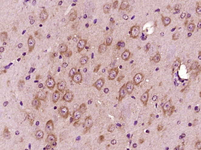 Anti-Beta-Amyloid 1-40 (CT) Polyclonal Antibody
