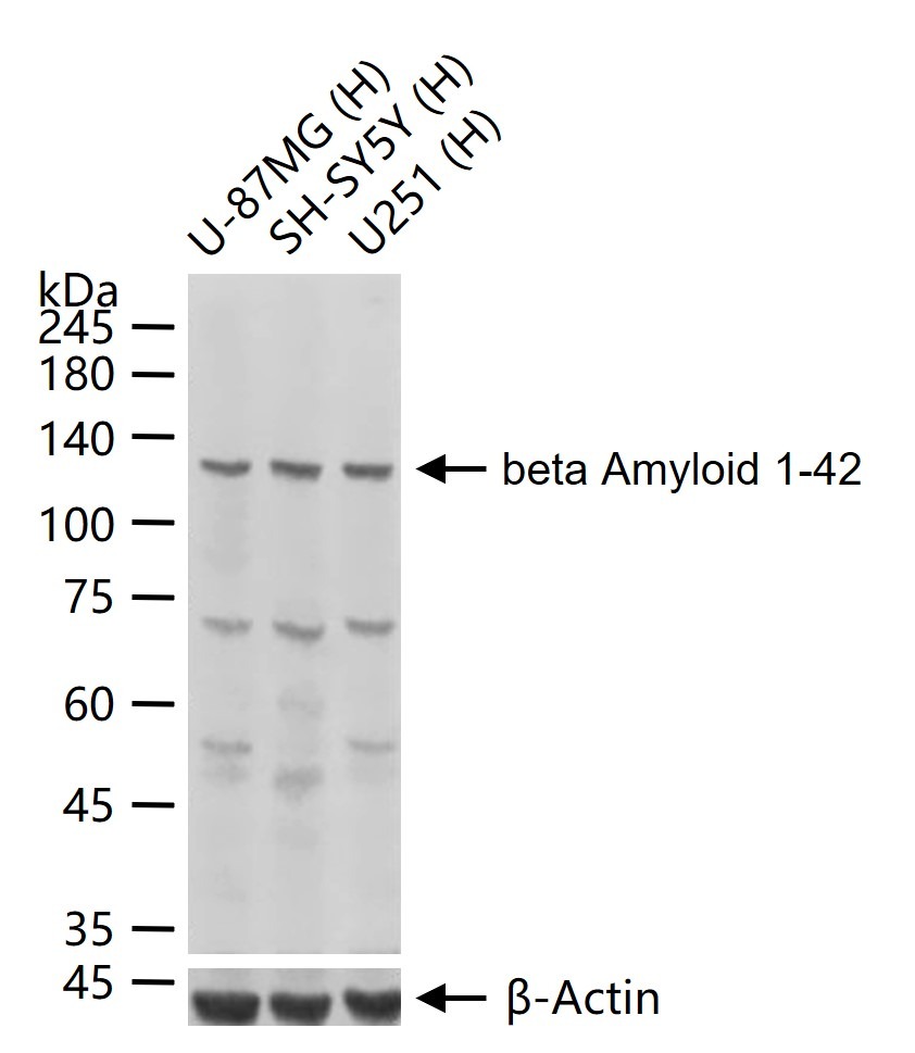 Anti-Beta-Amyloid 1-42 Polyclonal Antibody