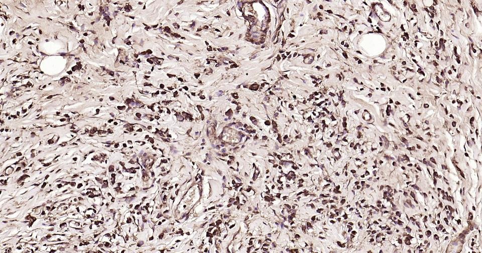 Beta-Tubulin Loading Control Antibody (1L64)