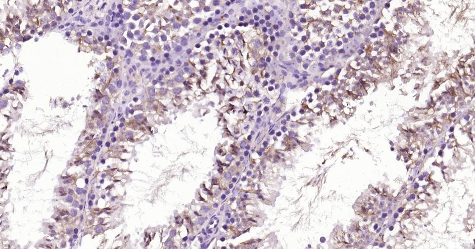 Beta-Tubulin Loading Control Antibody (8M945)