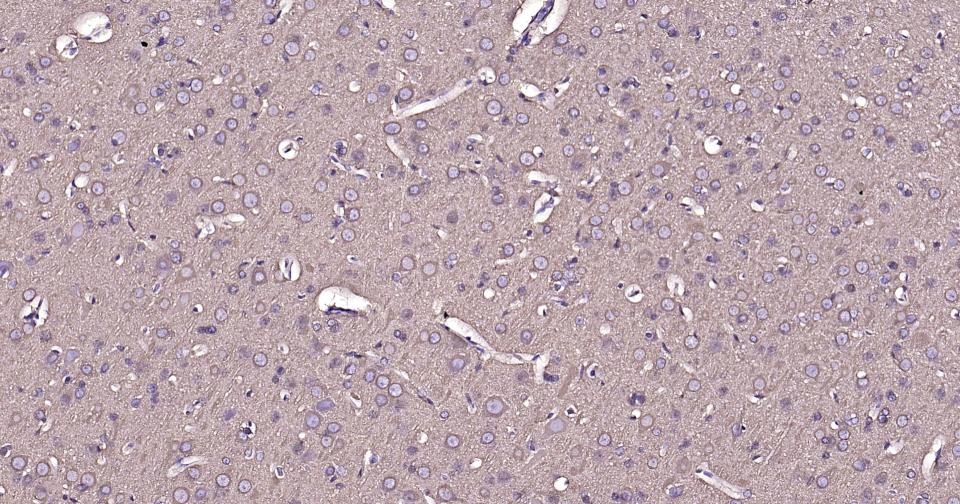 Beta-Tubulin Loading Control Antibody (1L64)