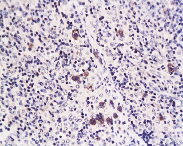 Anti-Caspase-1 p10 Polyclonal Antibody