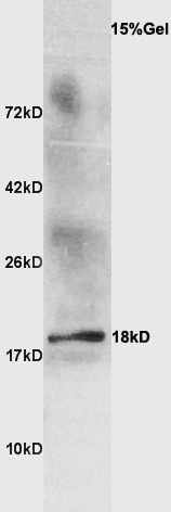 Anti-Beta-lactoglobulin Polyclonal Antibody