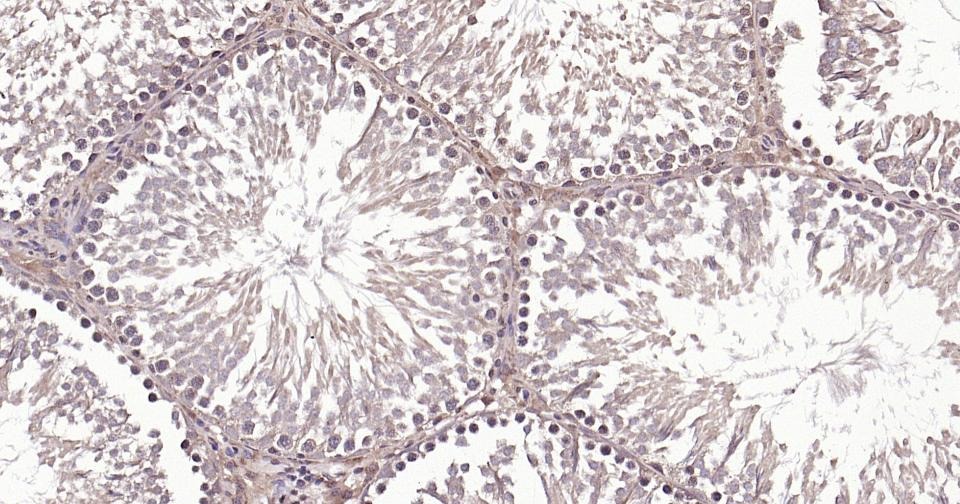 Beta-Tubulin Loading Control Polyclonal Antibody
