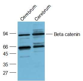Anti-Beta-Catenin Polyclonal Antibody