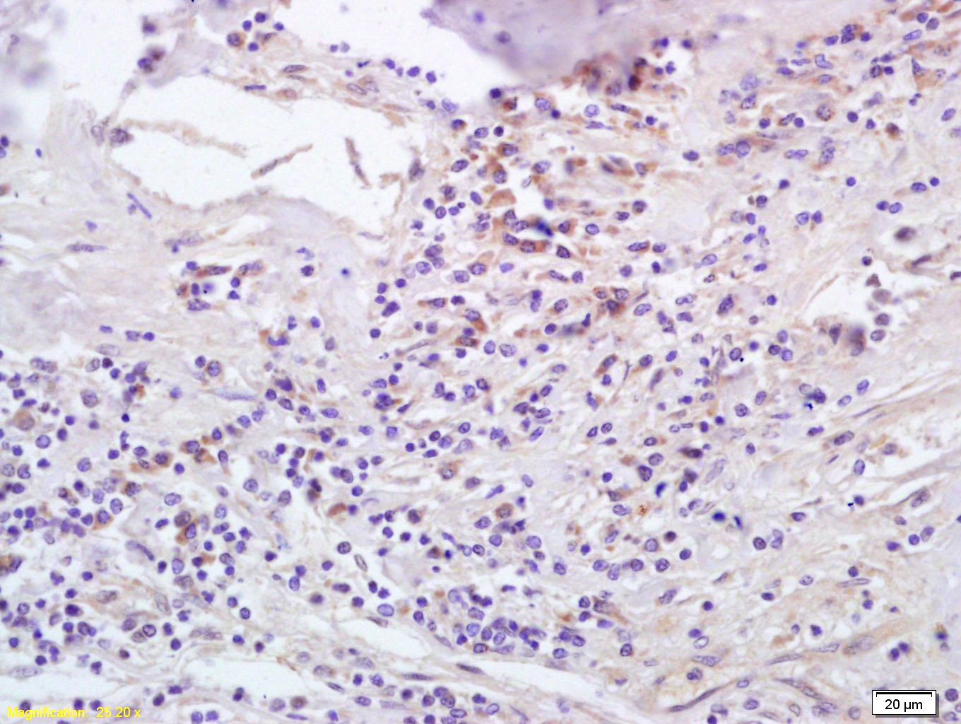 Anti-CCL5 Polyclonal Antibody 2