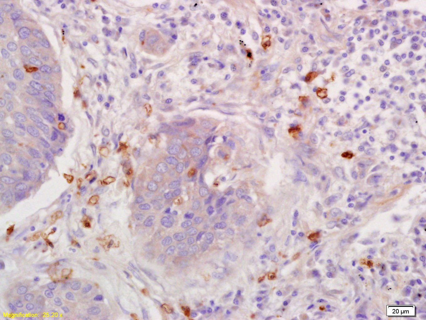 Anti-CCL5 Polyclonal Antibody 2