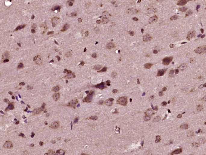Anti-Beta-Catenin Polyclonal Antibody 2