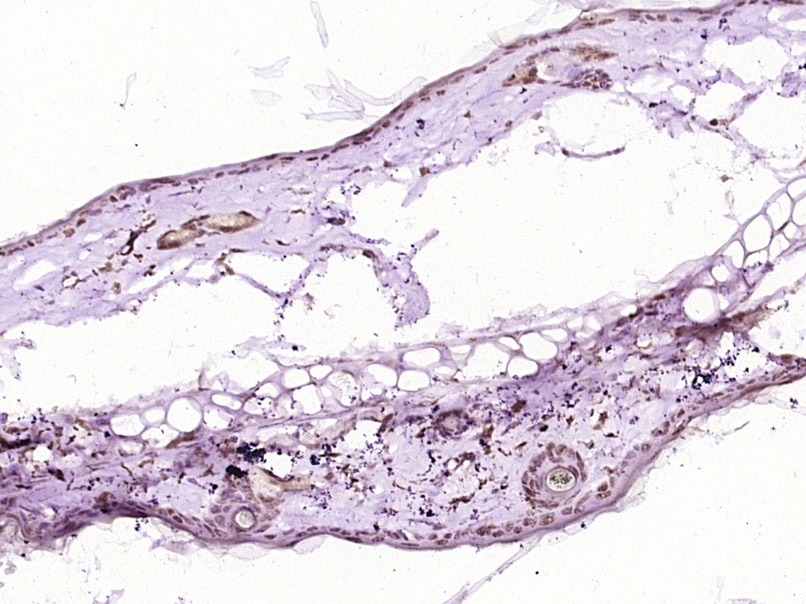 Anti-Beta-Catenin Polyclonal Antibody 2