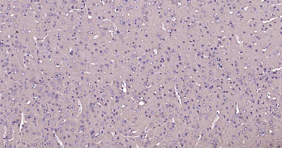 Beta-Tubulin Loading Control Antibody (1L64)