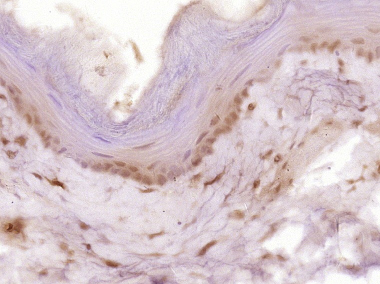 Anti-CCNB1 Polyclonal Antibody