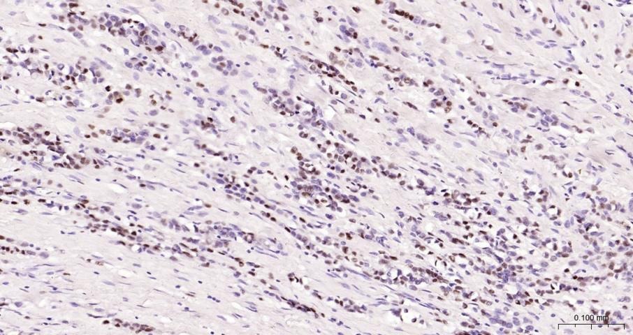 Anti-CCND1 Polyclonal Antibody