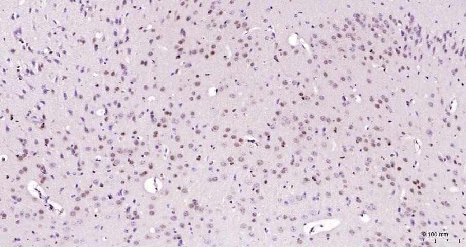 Anti-CCND1 Polyclonal Antibody