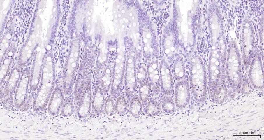 Anti-CCND1 Polyclonal Antibody